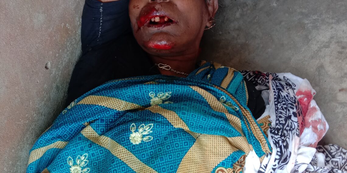 দর্মি পঞ্চবটীতে সড়ক দুর্ঘটনায় আহত মা-পুত্র