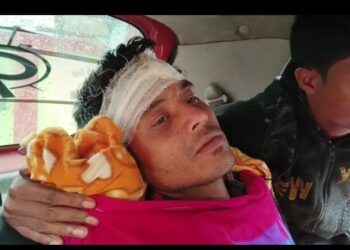 কালাইনে সড়ক দুর্ঘটনায় আহত ১