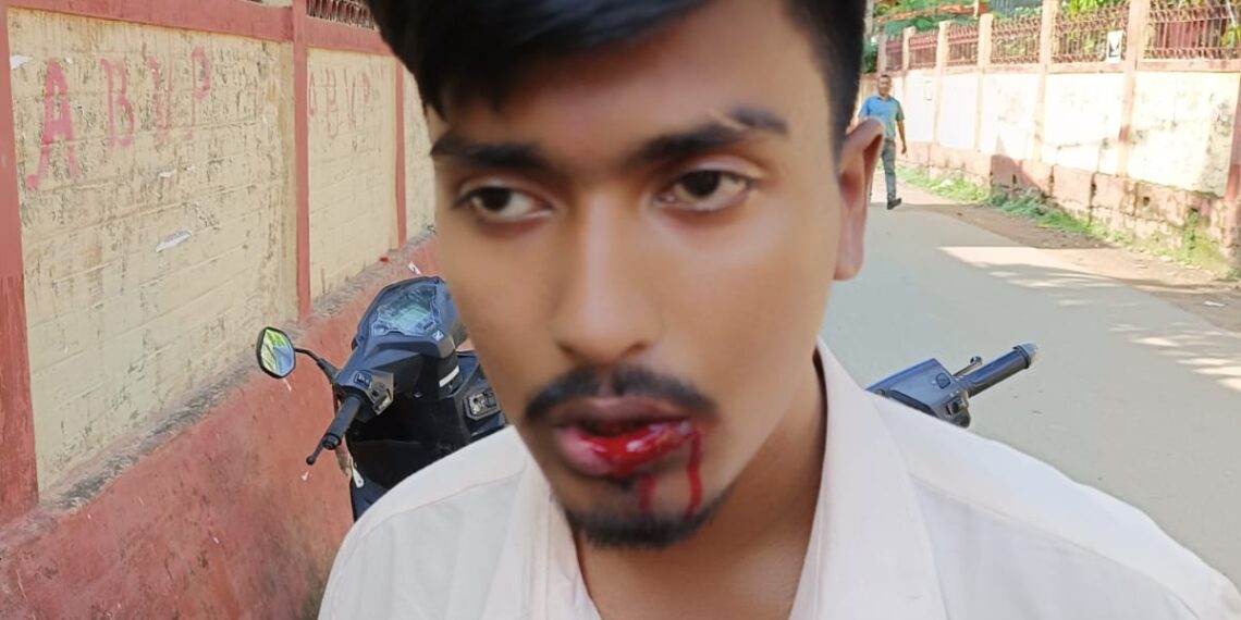 জিসি কলেজে মারপিটে আহত তৃণমূল পরিষদ সদস্য