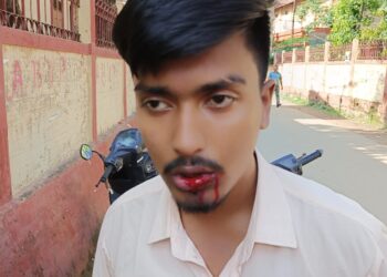 জিসি কলেজে মারপিটে আহত তৃণমূল পরিষদ সদস্য