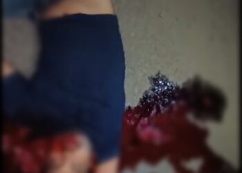 দুর্ঘটনায় মৃত্যুকে ঘিরে বাইপাসে উত্তেজনা,  আহত পুলিশ আধিকারিক, গাড়ি ভাঙচুর