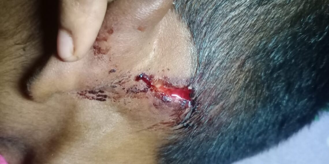 দিলখুশ জিপি-র  প্রাক্তন জিপি সভানেত্রীর স্বামীর বিরুদ্ধে মারপিটের অভিযোগ