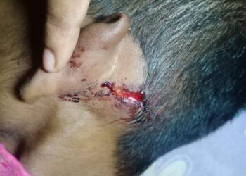 দিলখুশ জিপি-র  প্রাক্তন জিপি সভানেত্রীর স্বামীর বিরুদ্ধে মারপিটের অভিযোগ