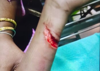 প্রধান শিক্ষকের ধারালো অস্ত্রের আঘাতে গুরুতর আহত ছাত্র