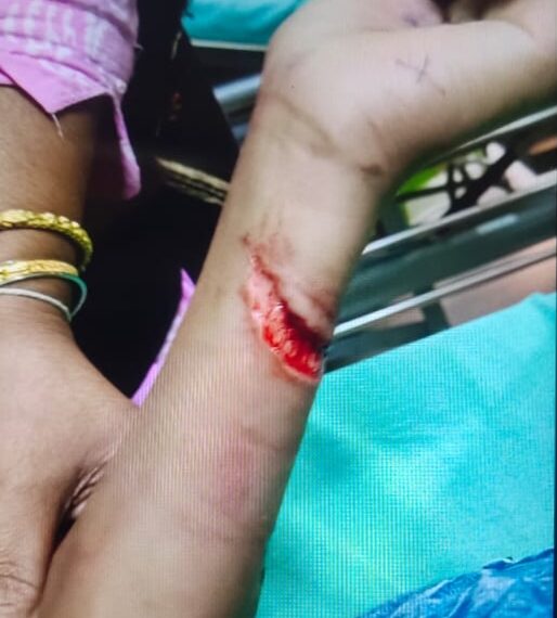 প্রধান শিক্ষকের ধারালো অস্ত্রের আঘাতে গুরুতর আহত ছাত্র